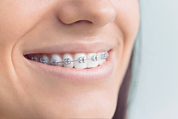 Why Choose Us for Your Dental Needs in Union City, IN